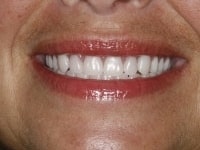 Konig Center for Cosmetic & Comprehensive Dentistry smile photos